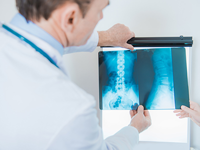 Neumologo en coyoacán en CDMX