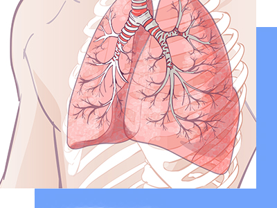 Cuando acudir a un neumólogo en CDMX